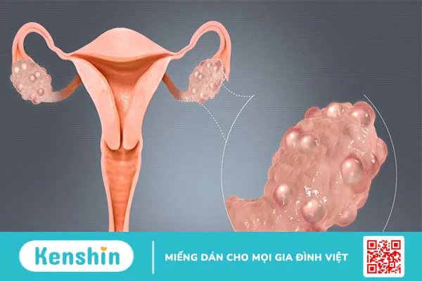 Hoài sơn (củ mài) là gì? Tác dụng của nó đối với sức khỏe