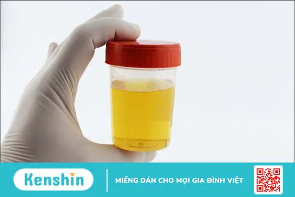 Hoàng bá có tác dụng gì? 17 bài thuốc chữa bệnh từ cây hoàng bá