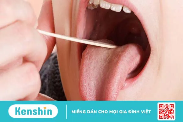 Hoàng bá có tác dụng gì? 17 bài thuốc chữa bệnh từ cây hoàng bá