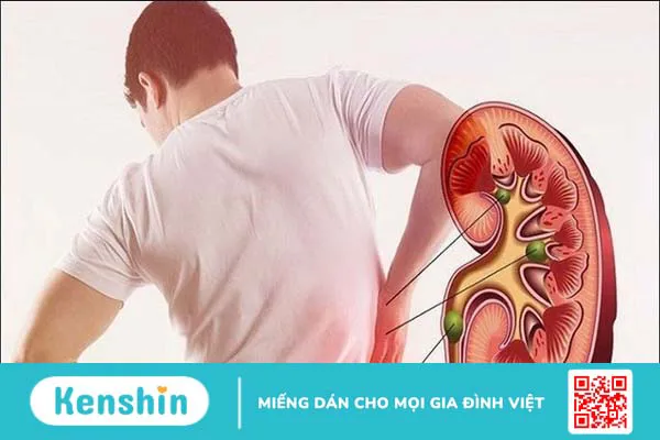 Hoàng kỳ có tác dụng gì? 9 Tác dụng với sức khỏe và các bài thuốc