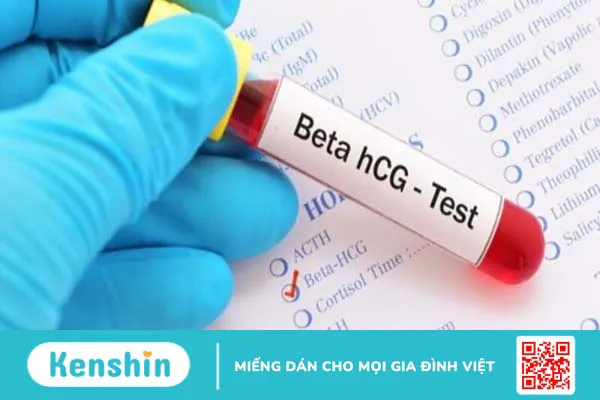 Hướng dẫn cách dùng que thử thai và đọc kết quả chi tiết tại nhà