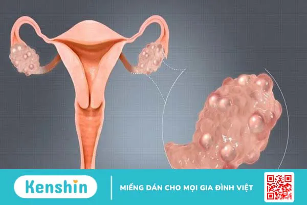 Hướng dẫn cách dùng que thử thai và đọc kết quả chi tiết tại nhà