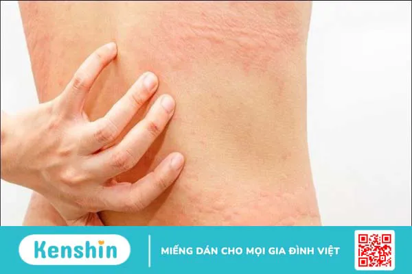 Hướng dẫn cách sử dụng bạc hà đúng cách an toàn và hiệu quả