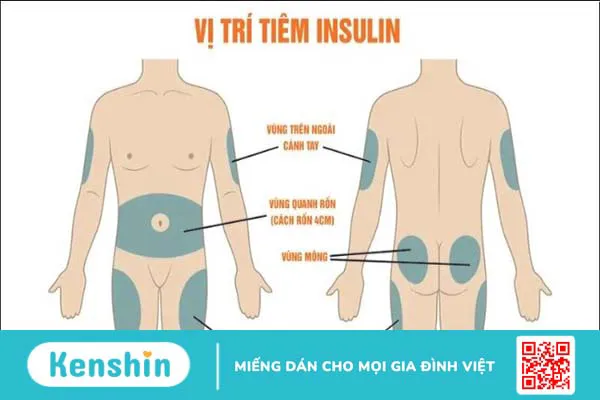 Hướng dẫn cách sử dụng bút tiêm insulin cho người bệnh tiểu đường