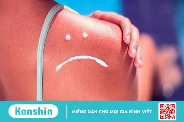 Hướng dẫn cách tắm nắng đúng để bổ sung vitamin D đúng cách