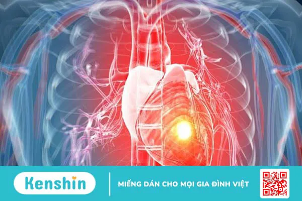 Hướng dẫn cách uống dầu cá đúng cách an toàn, hiệu quả