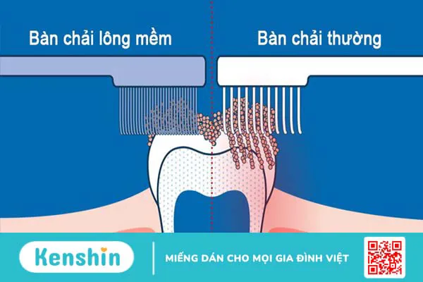 Hướng dẫn cách vệ sinh răng niềng tại nhà đúng cách