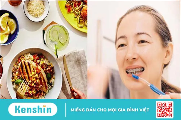 Hướng dẫn cách vệ sinh răng niềng tại nhà đúng cách