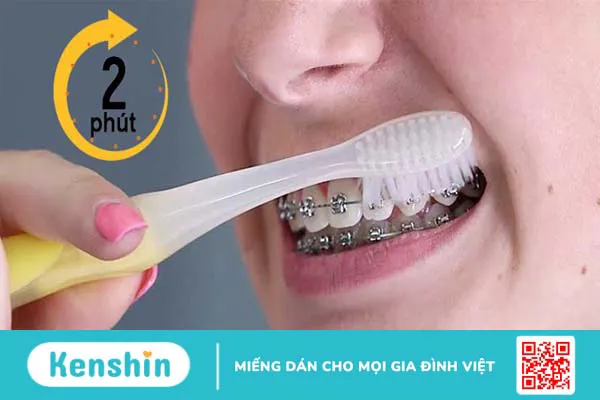 Hướng dẫn cách vệ sinh răng niềng tại nhà đúng cách