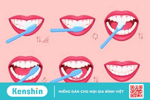 Hướng dẫn cách vệ sinh răng niềng tại nhà đúng cách