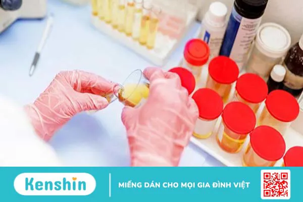 Hướng dẫn đọc các chỉ số xét nghiệm của nước tiểu bạn cần biết