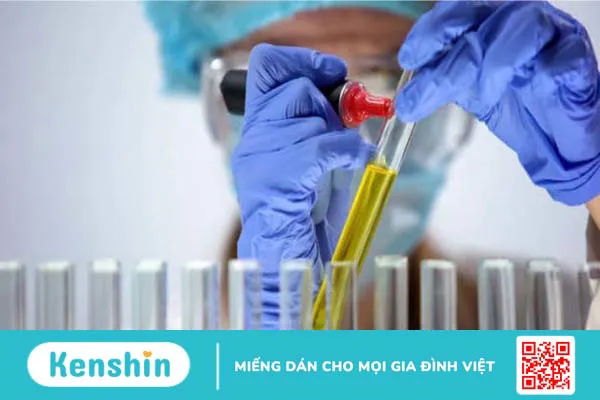 Hướng dẫn đọc các chỉ số xét nghiệm của nước tiểu bạn cần biết