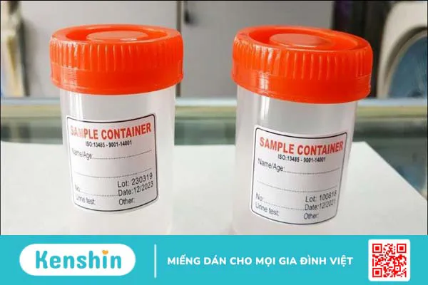 Hướng dẫn đọc các chỉ số xét nghiệm của nước tiểu bạn cần biết