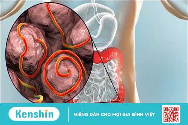 Hướng dẫn sử dụng thuốc tẩy giun đúng cách an toàn và hiệu quả