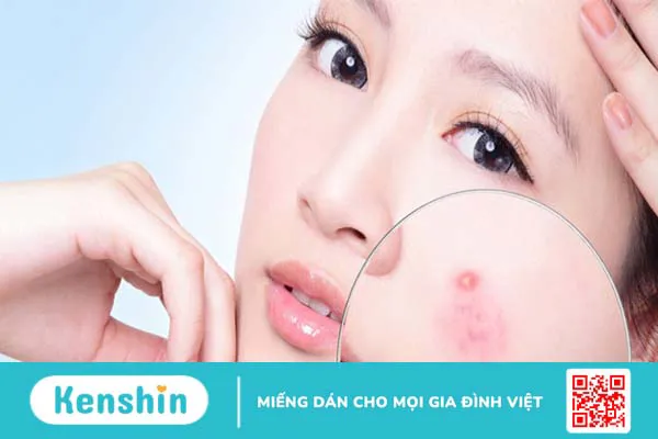 Hyaluronic Acid là gì? Công dụng của HA đối với làn da và sức khỏe