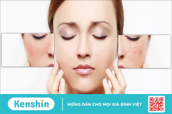 Hyaluronic Acid là gì? Công dụng của HA đối với làn da và sức khỏe