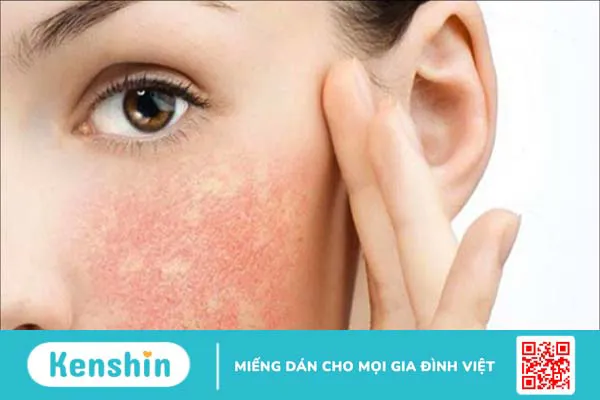 Hyaluronic Acid là gì? Công dụng của HA đối với làn da và sức khỏe