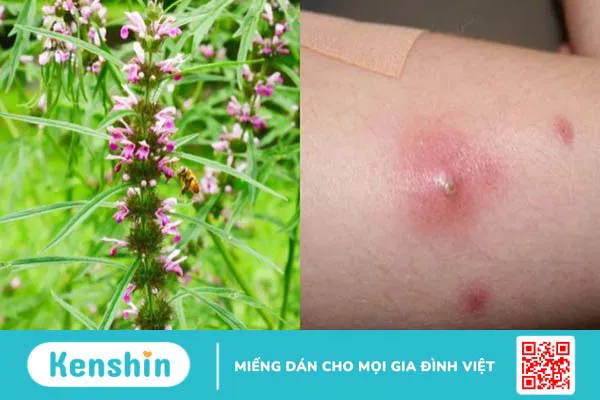 Ích mẫu: Cách dùng, liều dùng, lưu ý khi sử dụng