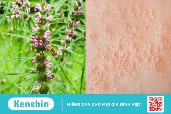 Ích mẫu: Cách dùng, liều dùng, lưu ý khi sử dụng