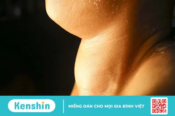 Iodine (Iốt) là gì? lợi ích, liều dùng, tác dụng phụ, những loại thực phẩm chứa nhiều i ốt