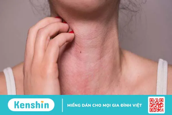 Kế sữa là gì? Có thể dùng kế sữa để phòng chống ung thư không?