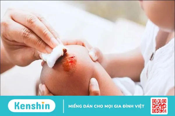 Khoai mì bao nhiêu calo? Cách ăn khoai mì giảm cân và lưu ý khi ăn