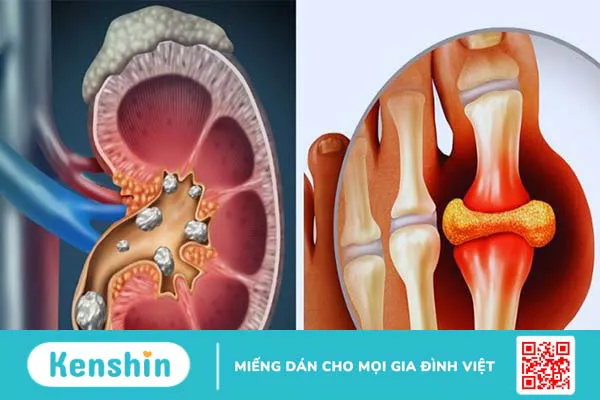 Khoai sọ bao nhiêu calo? Ăn khoai sọ có béo không? Các lưu ý khi ăn