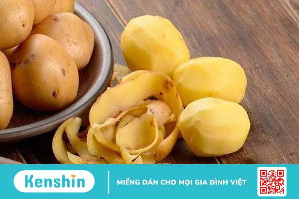 Khoai tây bao nhiêu calo? Ăn khoai tây có béo không và lưu ý khi ăn