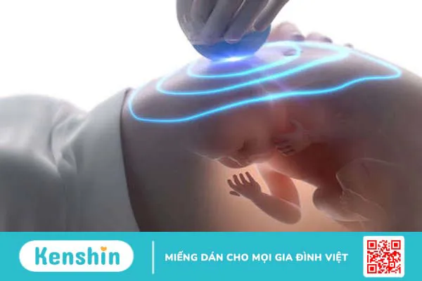 Kiểm tra cân nặng, sức khoẻ thai nhi các mẹ bầu nên biết