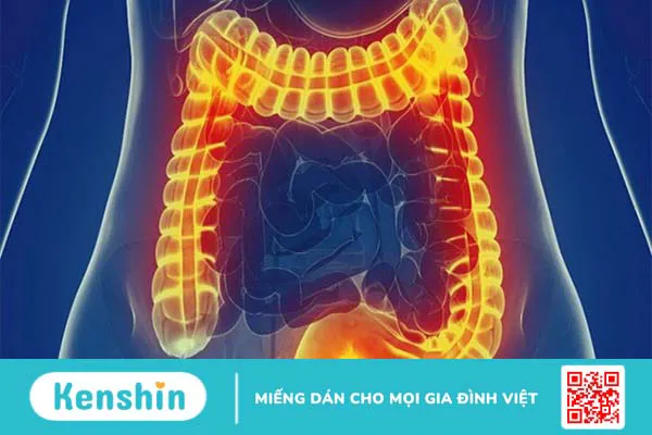 Kim chi bao nhiêu calo? Ăn kim chi có béo không? Lưu ý khi ăn