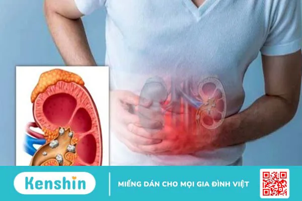 Kiwi có tác dụng gì? 21 lợi ích sức khỏe của kiwi ít người biết đến