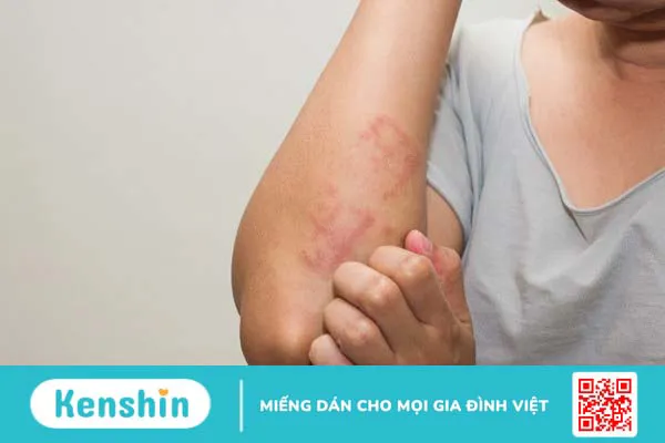 Kỷ tử là gì? Khám phá 7 tác dụng của kỷ tử trong y học và làm đẹp