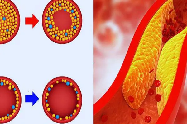 Lá ổi có tác dụng gì? 13 tác dụng của lá ổi có thể bạn chưa biết