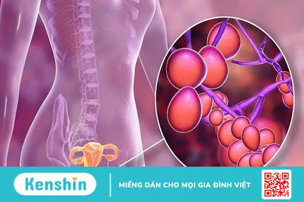 Lactobacillus acidophilus là gì? 14 tác dụng của Lactobacillus acidophilus đối với sức khỏe