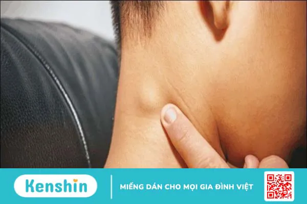 Làm sao phân biệt đậu mùa khỉ và thủy đậu khi cả hai đều có mụn nước