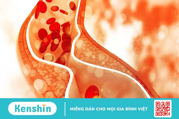 Lecithin đậu nành có tốt cho sức khỏe?