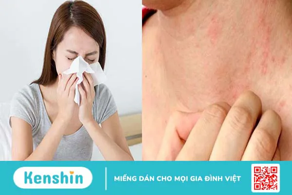 Liều dùng, cách dùng của Telfast 180mg? Lưu ý khi sử dụng