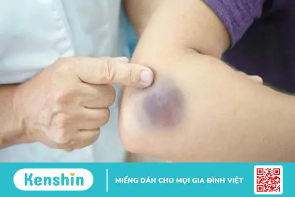 Lợi ích sức khỏe của chiết xuất hạt nho