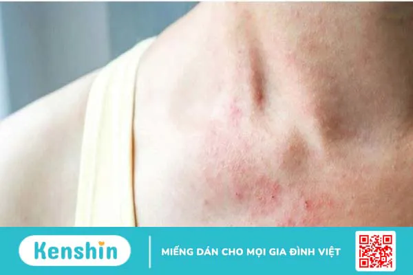 Lợi ích sức khỏe của chiết xuất hạt nho