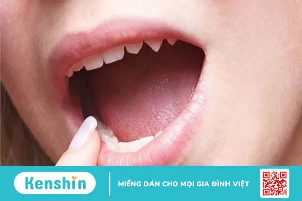 Lưỡi trắng là bệnh gì? 8 nguyên nhân phổ biến gây bệnh bạn nên biết