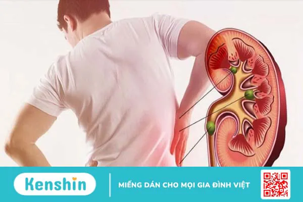 Lưu ý khi dùng cà gai leo bạn không nên bỏ qua