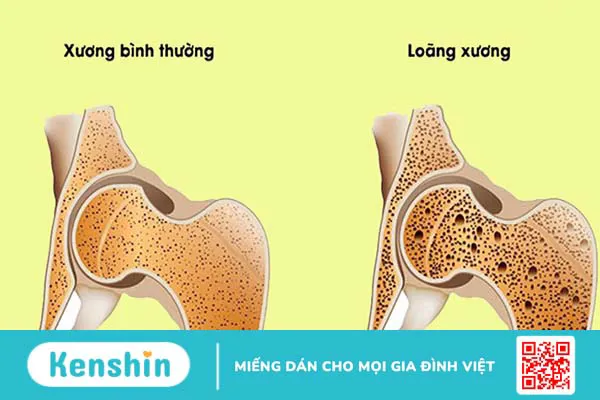 Magie có giúp giảm các triệu chứng mãn kinh không?