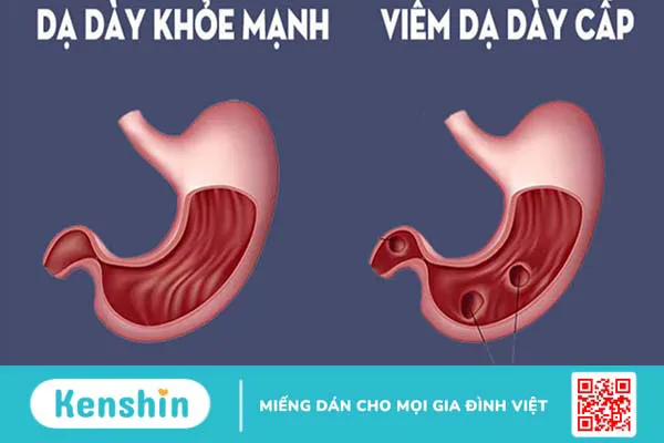 Magie là gì? Tác dụng, cách dùng, tác dụng phụ, thực phẩm giàu magie