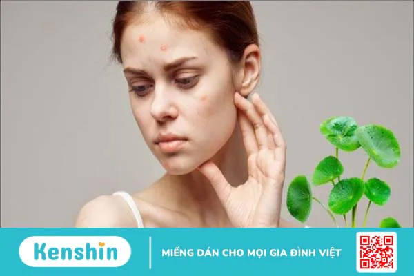 Mặt nạ rau má có tác dụng gì? 11 tác dụng của rau má với làn da bạn