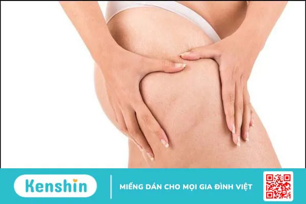 Mặt nạ rau má có tác dụng gì? 11 tác dụng của rau má với làn da bạn