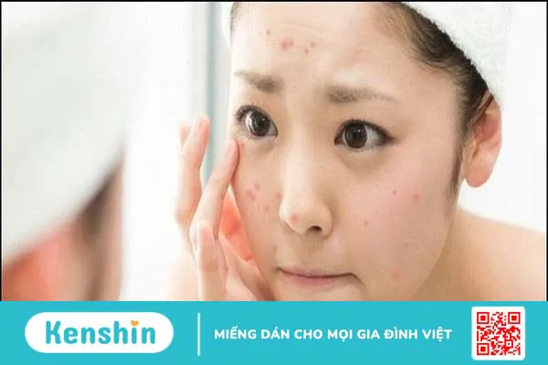 Mặt nạ rau má có tác dụng gì? 11 tác dụng của rau má với làn da bạn