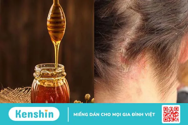 Mặt nạ tóc từ mật ong: công dụng, cách làm đơn giản tại nhà