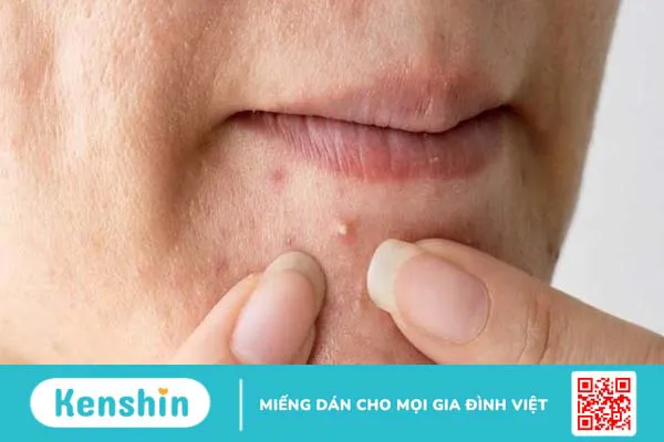 Mặt nạ vitamin c có tác dụng gì? Các loại mặt nạ vitamin C và cách đắp