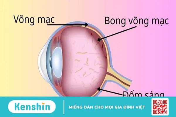 Mắt nhìn thấy đốm sáng là gì? Nguyên nhân và cách phòng tránh