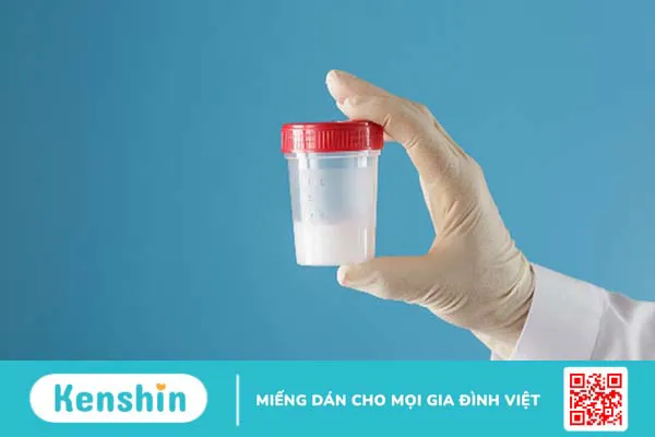 Màu tinh dịch giúp bạn nhận biết bệnh gì? Xem ngay